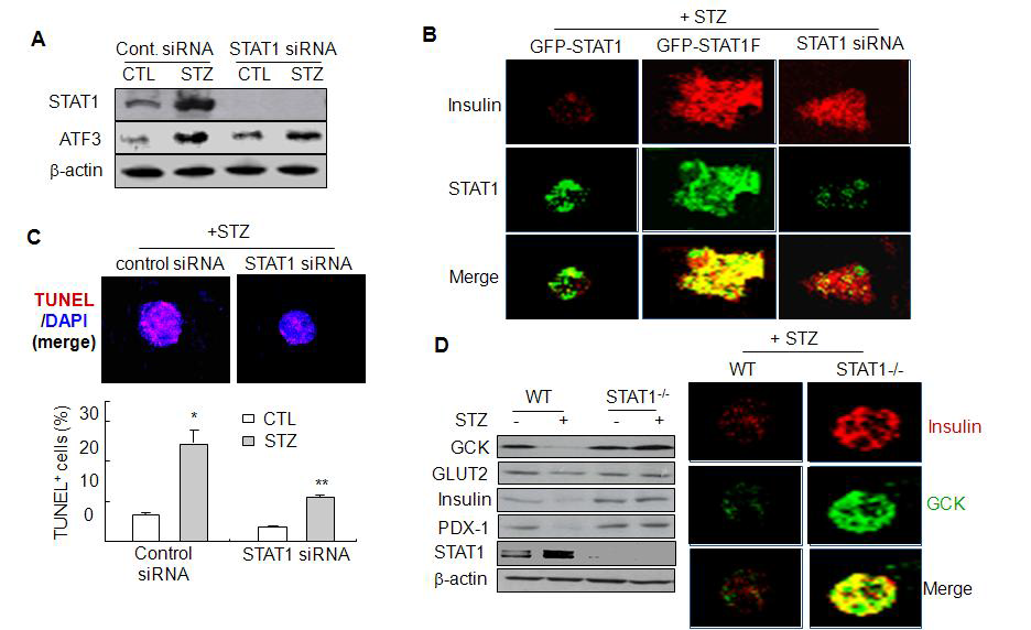 STAT1 knockdown inhibits STZ-mediated β-cell dysfunction and apoptosis