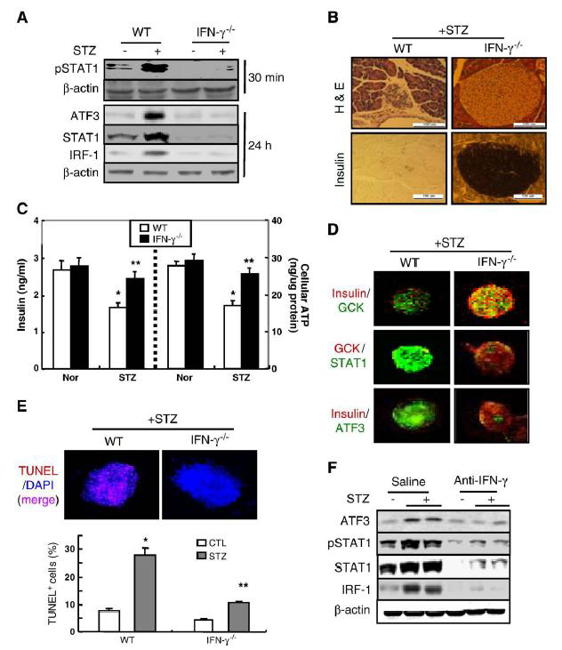 STZ-mediated ATF3 induction, β-cell dysfunction and apoptosis are abolished in IFN-γ-/- mice