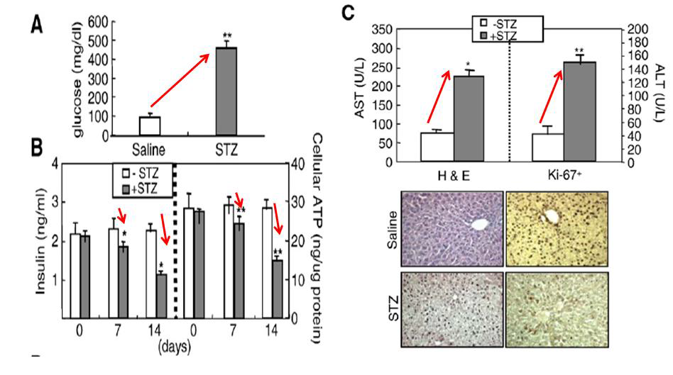 STZ induces diabetic liver injury