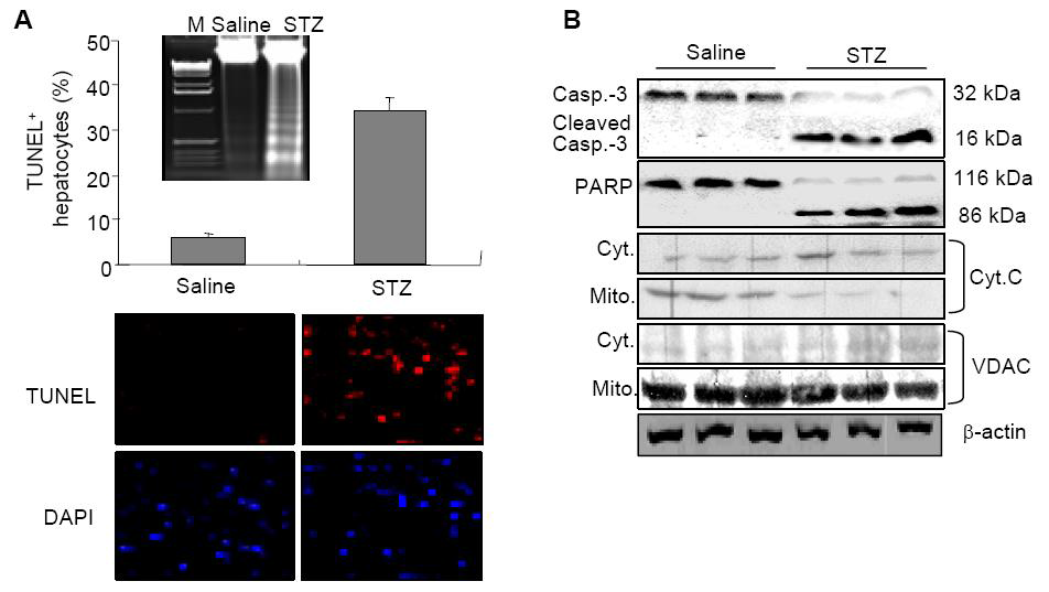 STZ induced hepatocyte apoptosis