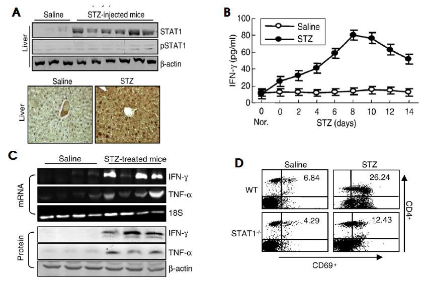 STZ induces diabetic liver injury and IFN-γ/STAT1 expression