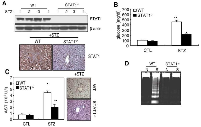 STAT1 is essential for STZ-induced liver injury and diabetes