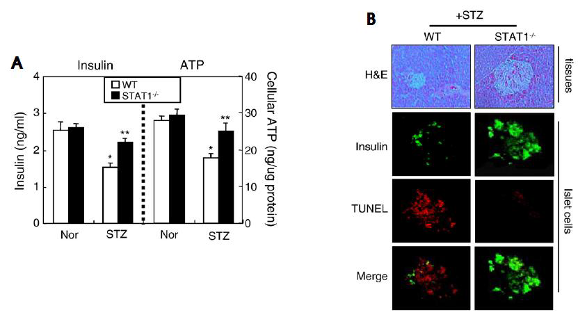 STAT1 is essential for STZ-induced diabetes