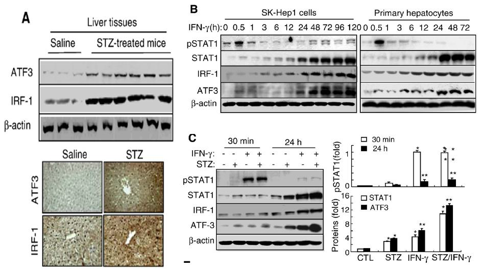 STZ and or IFN-γ induced ATF3