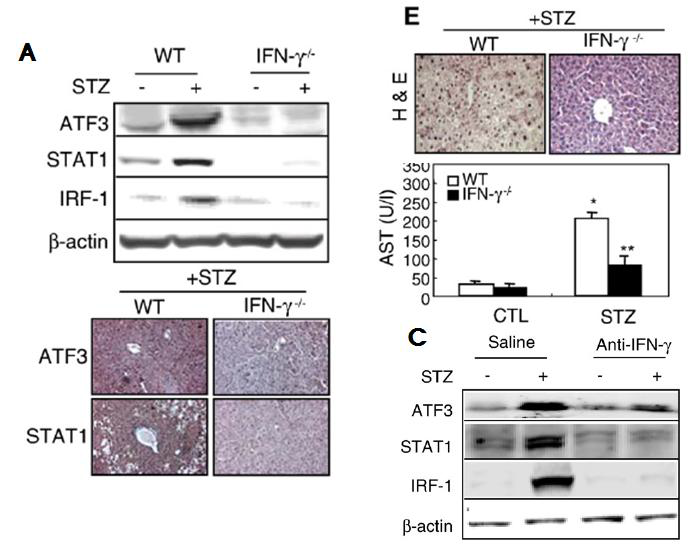 ATF3 induced by STZ or IFN-γ was abolished in IFN-γ-/- mice