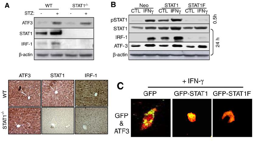 STAT1 is required for ATF3 translocation but not for ATF3 protein expression in hepatocytes