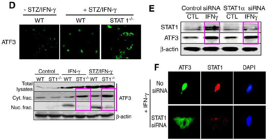 STAT1 is required for ATF3 translocation but not for ATF3 protein expression in hepatocytes