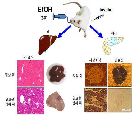 Development of fatty liver and pancreatic β-cell apoptosis in chronic alcohol-fed mice