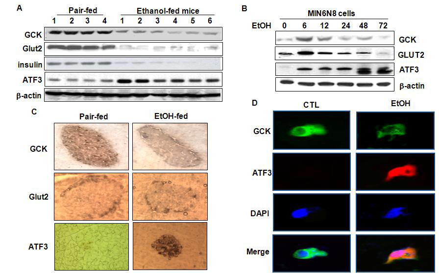 Chronic alcohol consumption downregulates GCK and Glut2 expression in Pancreatic beta-cells