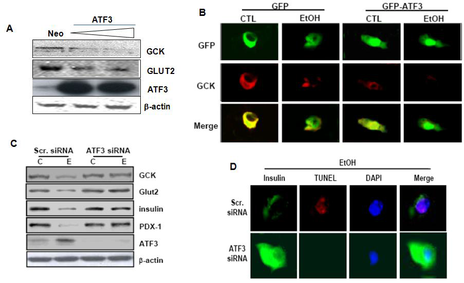 Effects of ATF3 on ethanol-mediated GCK downregulation, insulin synthesis, and apoptosis