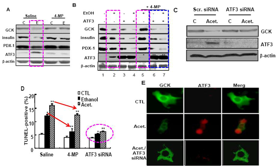 Ethanol metabolism is essential for alcohol-induced GCK downregulation and apoptosis