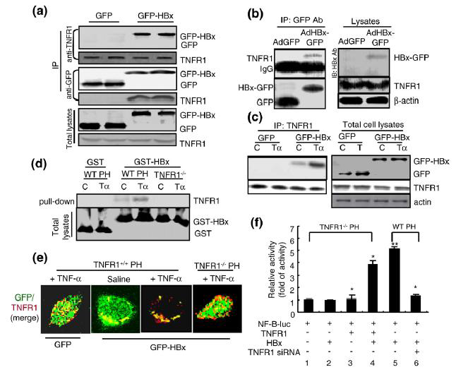 HBx directly interacts with TNFR1 and colocalizes in the plasma membrane