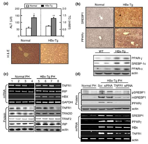 TNFR1 plays an important role in HBx-mediated steatosis