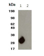 Western blot of B. pseudomallei LPS with melioidosis patient serum