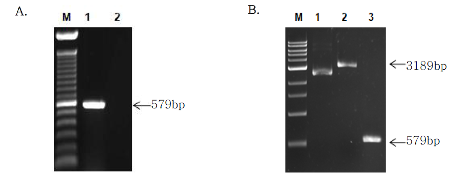 Analysis of SOD gene amplified by the PCR and identification of recombinant plasmid containing SOD gene fragment