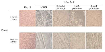 Changes of cell morphology of C2C12 myotube treated with or without of palmitate and horse serum for 24 h.