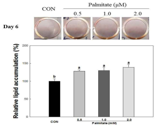 Changes of lipid accumulation in C2C12 myotube treated with or without of palmitate and horse serum for 24 h.