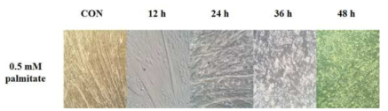 Change of cell morphology of C2C12 myotubes treated with or without of palmitate during indicated time courses.