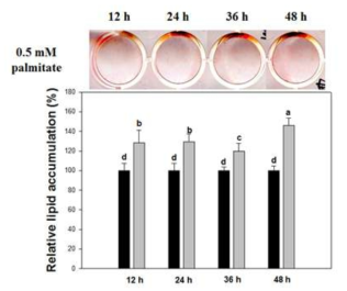 Lipid accumulation in C2C12 myotubes treated with or without of palmitate during indicated time courses
