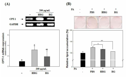 Effect of HRG and RG on the mRNA expression of CPT-1 (A) and β-oxidation (B).