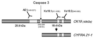 CYFRA 21-1과 KS 19.1과 KS 19.2의 결합자리