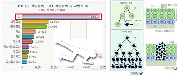 (좌) 한국인의 사망원인 통계, (우) 정상세포와 암세포의 분화