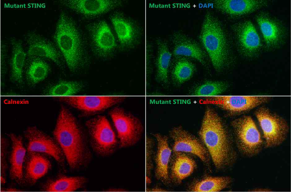 돌연변이 STING을 안정적으로 발현하는 HeLa 세포주