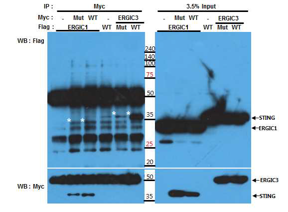 전기영동을 통한 STING과 ERGIC1, STING과 ERGIC3의 결합 확인
