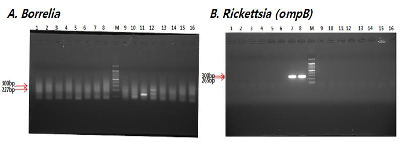 진드기로부터 Borrelia, Rickettsia를 nested PCR로 검출한 결과