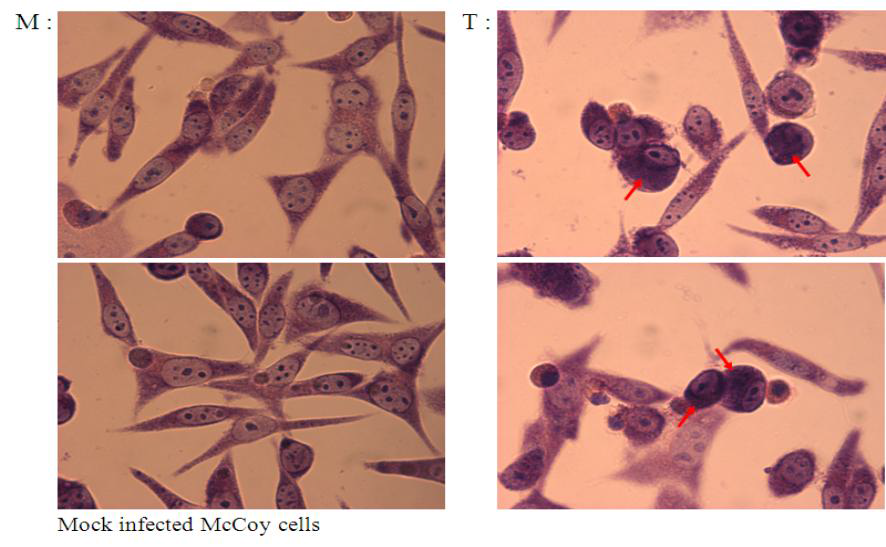 McCoy cell에 접종 후 배양된 Chlamydia trachomatis의 Giemsa staining 결과