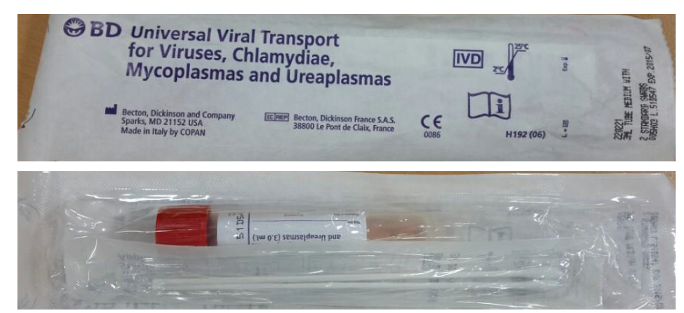 본 연구에 사용한 C. trachomatis의 임상 검체 분리를 위한 swab과 transport medium