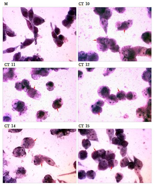 McCoy 세포에 접종 후 배양된 C. trachomatis 기탁신청 strain의 Giemsa staining 결과