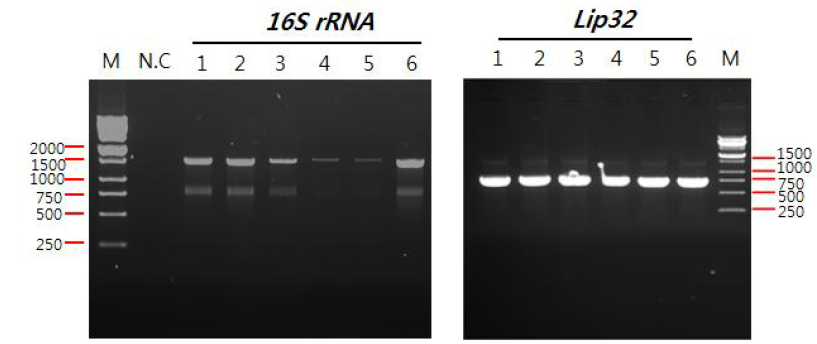 PCR로 16S rRNA (왼쪽), LipL32 (오른쪽) 유전자를 증폭한 결과