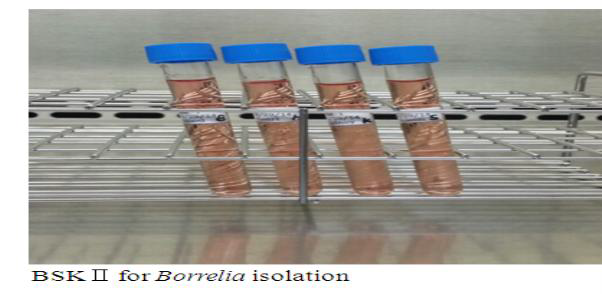 Borrelia 분리 및 배양을 위해 사용하는 접종 배지