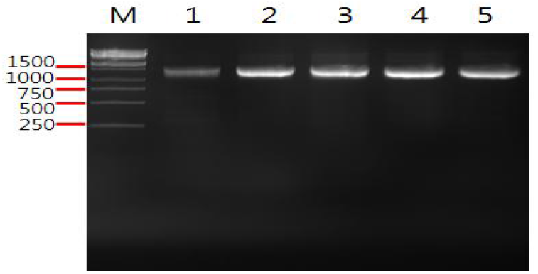 PCR로 16S rDNA 유전자를 증폭한 결과