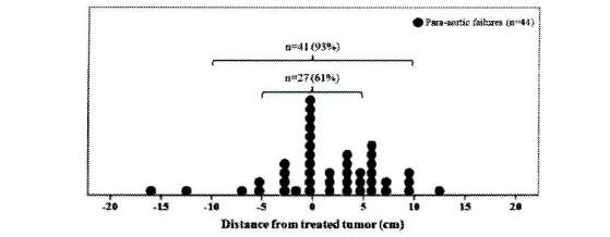 Distribution of para-aortic failures para-aortic failure was detected in 38(44 lesions) of 88 patients(43%)