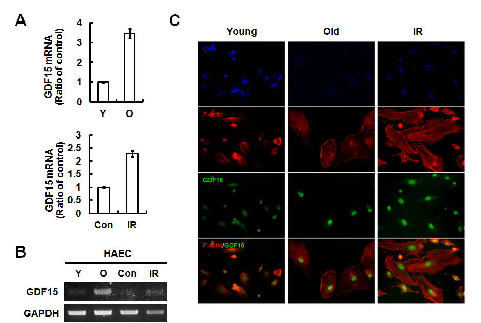 방사선 유도노화에서 GDF15 발현 증가