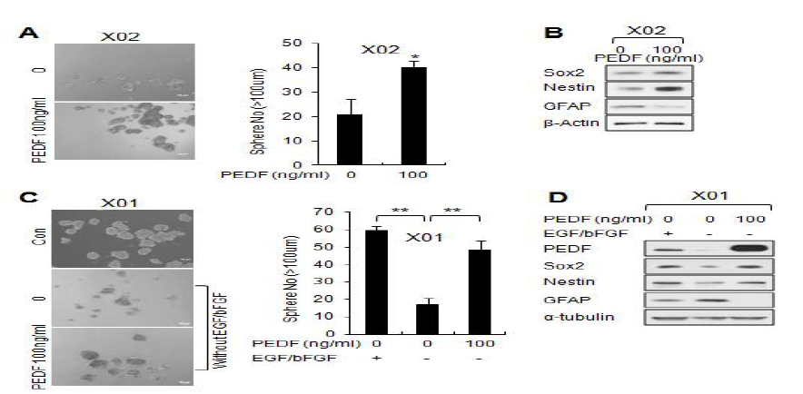 PEDF에 의한 뇌암줄기세포의 줄기화 증가