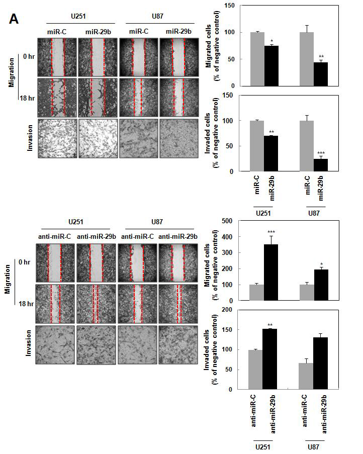 miR-29b의 암세포의 이동성/침윤 및 중간엽세포화 억제