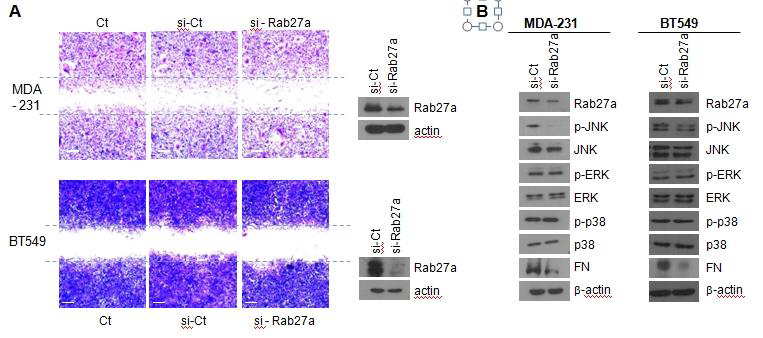 si-Rab27a에 의한 침윤/전이억제 효능