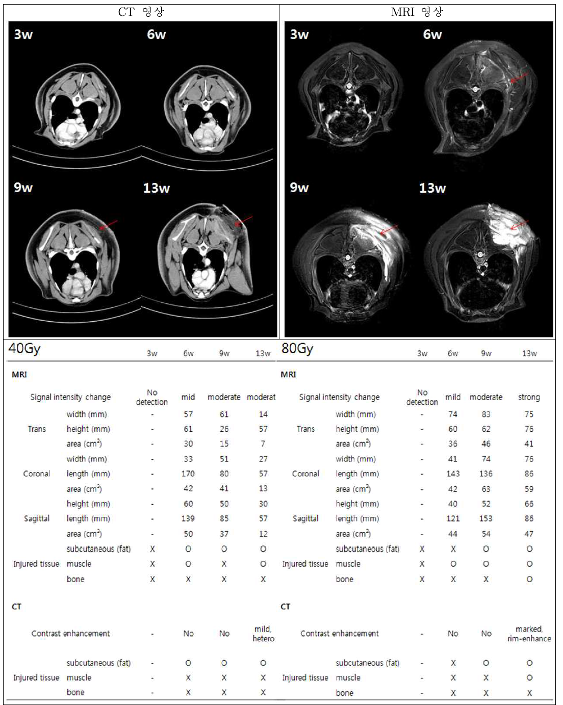 손상 진행에 따른 CT/MRI 영상 분석 결과