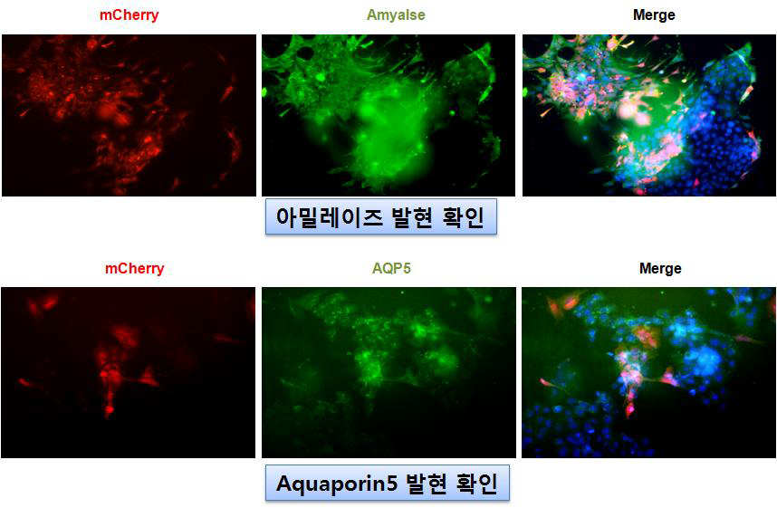 휴먼 iPS세포 유래 acinar 세포분화유도 후 아밀레이즈 및 aquporin 5발현 확인