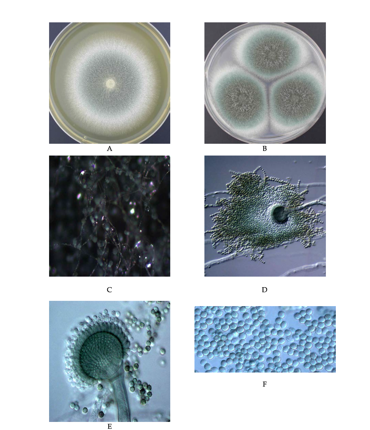 Morphological analysis of Aspergillus fumigatus