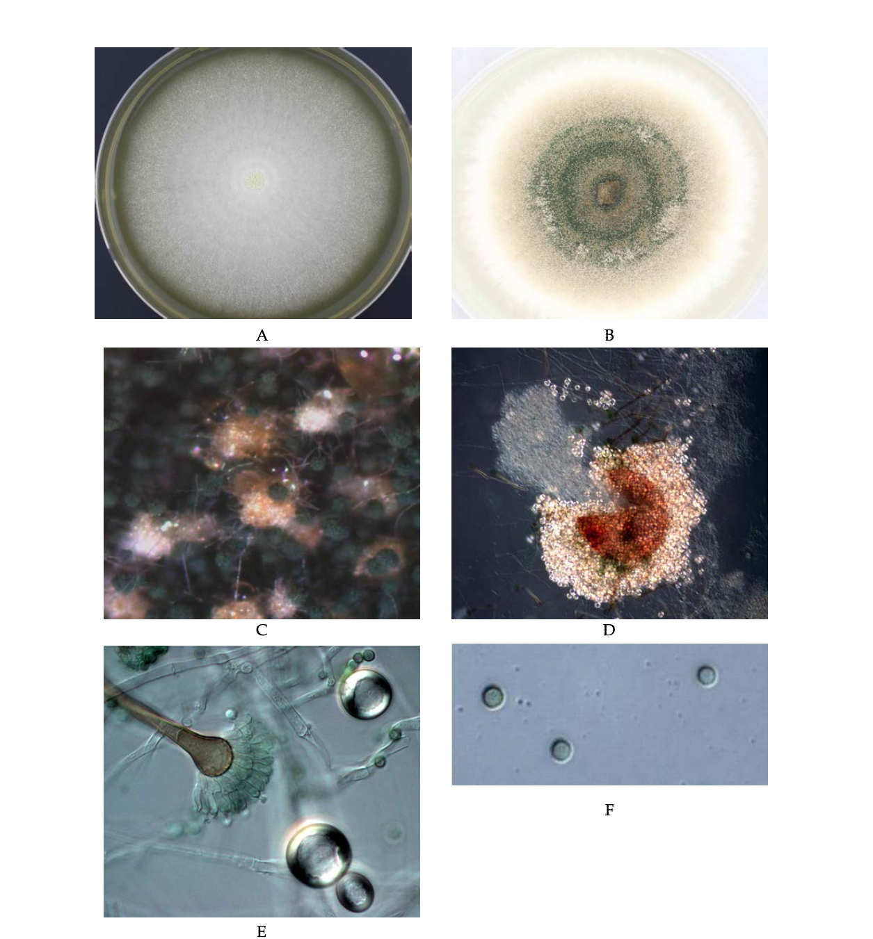 Morphological analysis of Aspergillus nidulans