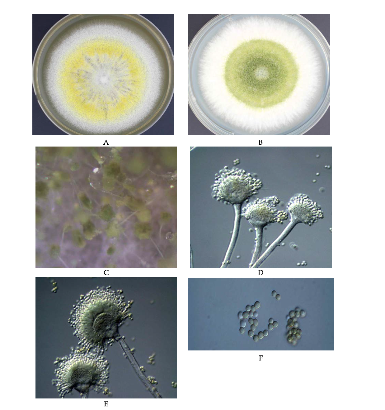 Morphological analysis of Aspergillus flavus