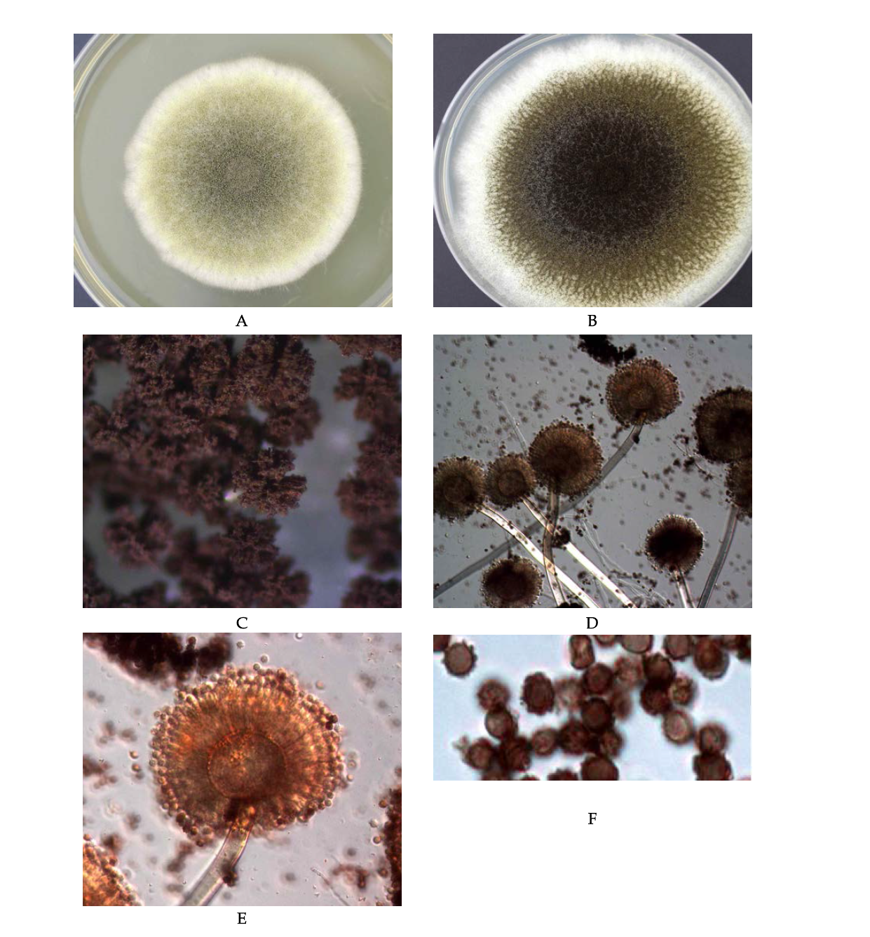 Morphological analysis of Aspergillus niger