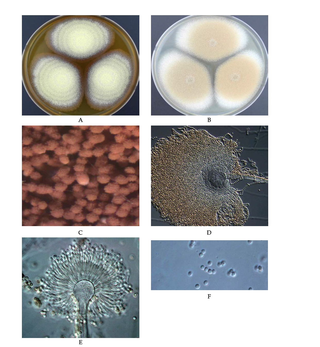 Morphological analysis of Aspergillus terreus