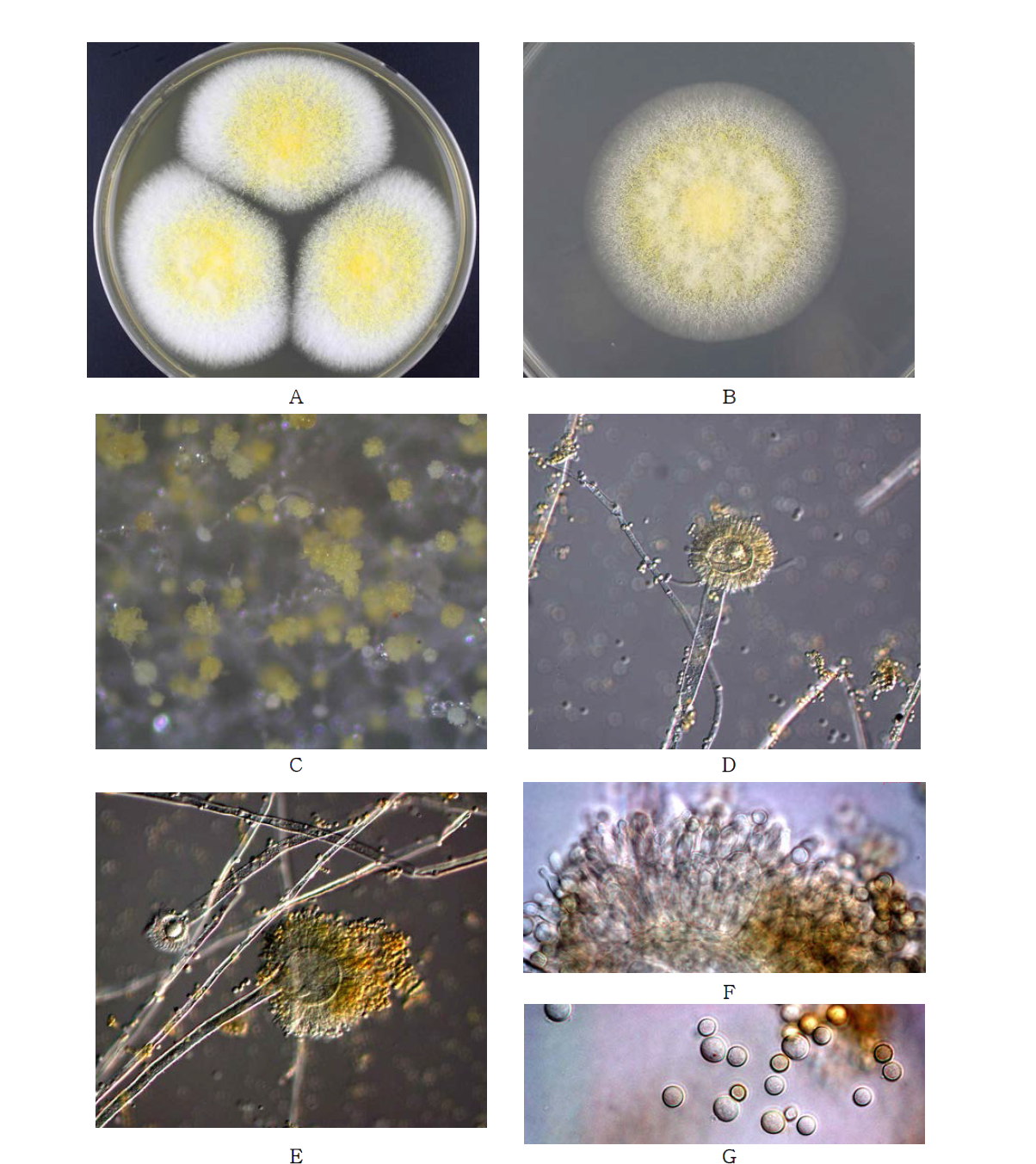 Morphological analysis of Aspergillus oryzae.