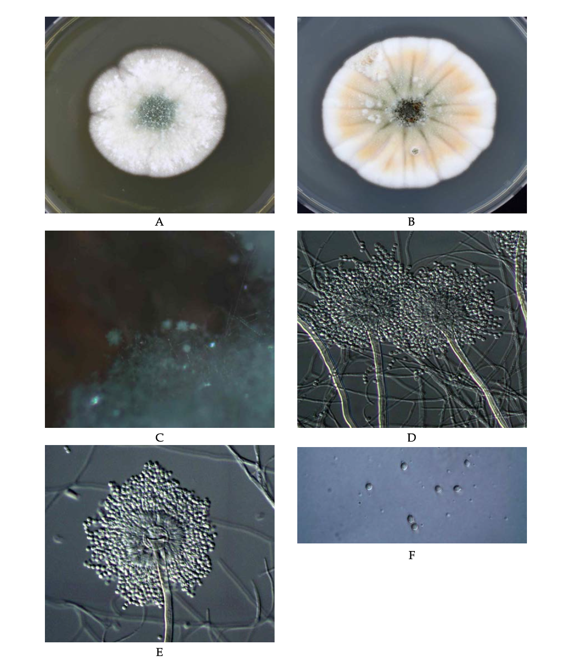 Morphological analysis of Aspergillus versicolor