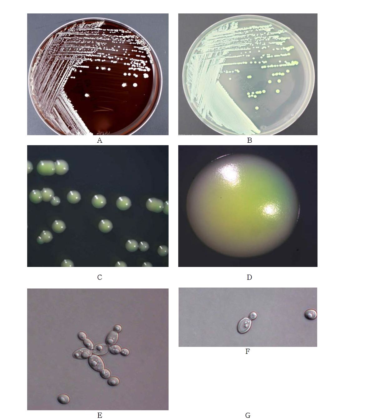 Morphological analysis of Candida albicans